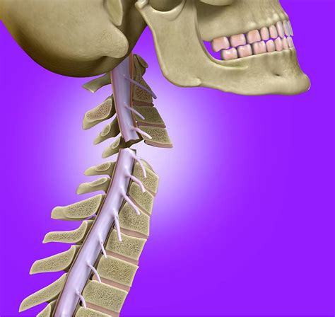neck broken by an angel (arturito .